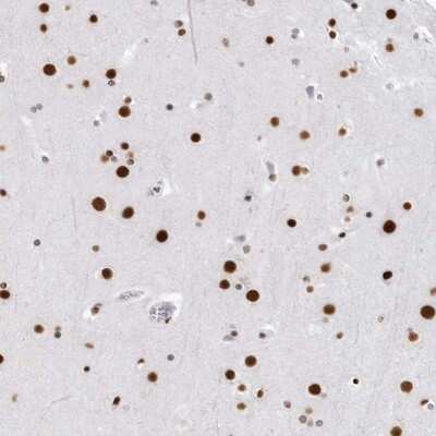 Immunohistochemistry-Paraffin: RNA Helicase A Antibody [NBP1-85266]