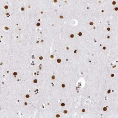 Immunohistochemistry-Paraffin: RNA Helicase A Antibody [NBP1-85266]