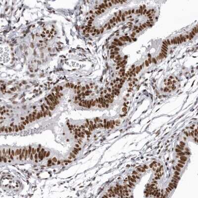 Immunohistochemistry-Paraffin: RNA Helicase A Antibody [NBP1-85266]