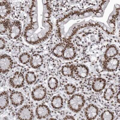 Immunohistochemistry-Paraffin: RNA Helicase A Antibody [NBP1-85266]