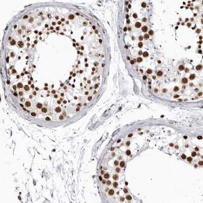 Immunohistochemistry-Paraffin: RNA Helicase A Antibody [NBP1-85266]