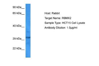 Western Blot: RNA binding motif protein, X-linked 2 Antibody [NBP2-83453]