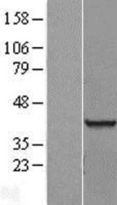 Western Blot: RNA binding motif protein, X-linked 2 Overexpression Lysate [NBL1-15223]
