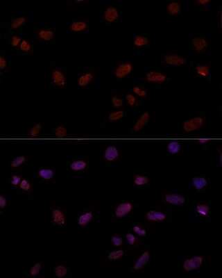 Immunocytochemistry/ Immunofluorescence: RNA polymerase I termination factor Antibody - Azide and BSA Free [NBP3-03880]