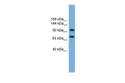 Western Blot: RNA polymerase I termination factor Antibody [NBP3-10414]