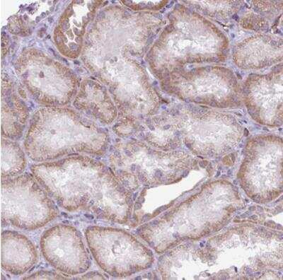 Immunohistochemistry: RNASE10 Antibody [NBP2-30865]