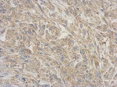 Immunohistochemistry-Paraffin: RNASE11 Antibody [NBP2-20172]