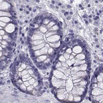 Immunohistochemistry-Paraffin: RNASE12 Antibody [NBP1-94162]