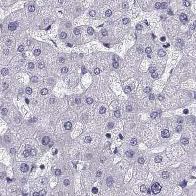 Immunohistochemistry-Paraffin: RNASE12 Antibody [NBP2-62631]