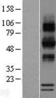 Western Blot: RNASE12 Overexpression Lysate [NBP2-08640]