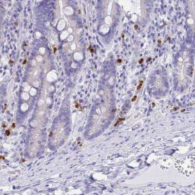 Immunohistochemistry-Paraffin: RNASE3 Antibody [NBP2-33778]