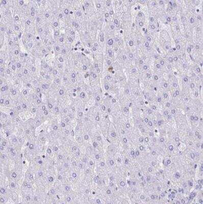 Immunohistochemistry-Paraffin: RNASE3 Antibody [NBP2-33778]