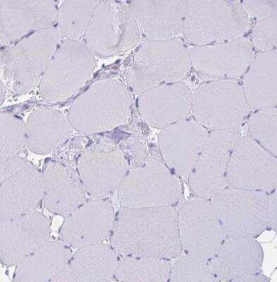 Immunohistochemistry-Paraffin: RNASE3 Antibody [NBP2-33778]