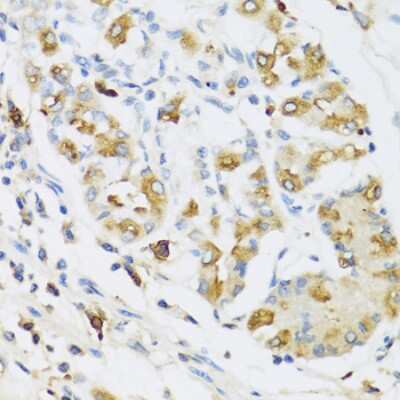 Immunohistochemistry-Paraffin: RNASE3 Antibody - BSA Free [NBP2-93655]