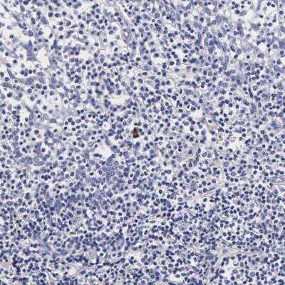 Immunohistochemistry-Paraffin: RNASE6 Antibody [NBP1-80822]