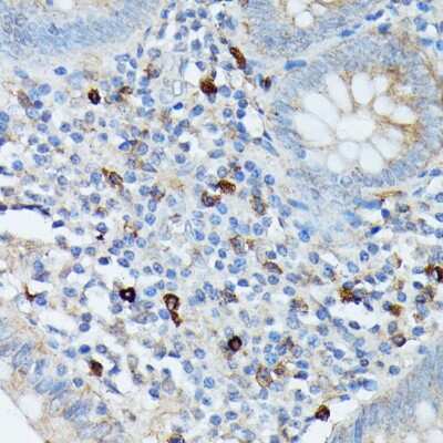 Immunohistochemistry-Paraffin: RNASE6 Antibody - Azide and BSA Free [NBP2-94645]