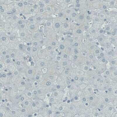 Immunohistochemistry-Paraffin: RNASE7 Antibody (CL0223) [NBP2-52883]