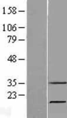 Western Blot: RNASE7 Overexpression Lysate [NBP2-05996]