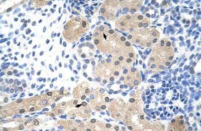 Immunohistochemistry-Paraffin: RNASEH2A Antibody [NBP1-58235]