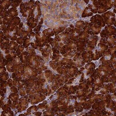 Immunohistochemistry-Paraffin: RNASEK Antibody [NBP1-92338]