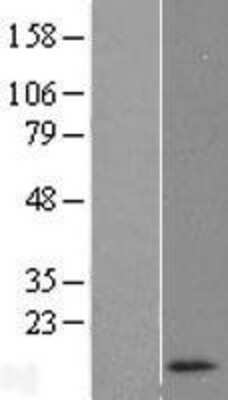 Western Blot: RNASEK Overexpression Lysate [NBL1-15401]