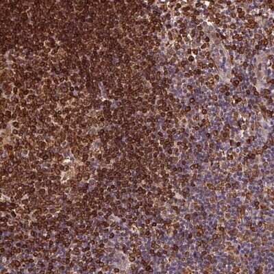 Immunohistochemistry-Paraffin: RNASET2 Antibody [NBP2-49484]