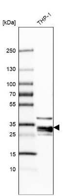 Western Blot: RNASET2 Antibody [NBP1-88753]