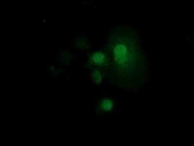 Immunocytochemistry/ Immunofluorescence: RND1 Antibody (OTI1C3) - Azide and BSA Free [NBP2-73919]