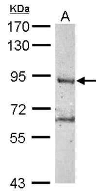 Western Blot: RNF10 Antibody [NBP2-20174]