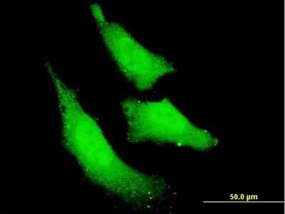 Immunocytochemistry/ Immunofluorescence: RNF111 Antibody (1C4) [H00054778-M05]