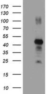 Western Blot: RNF113B Antibody (OTI7A1) [NBP2-01644]