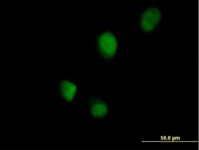 Immunocytochemistry/ Immunofluorescence: RNF113B Antibody [H00140432-B01P]