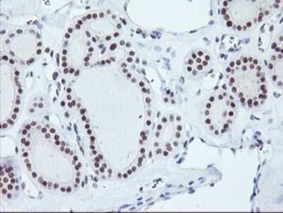 Immunohistochemistry: RNF113B Antibody (OTI7A1) - Azide and BSA Free [NBP2-73921]