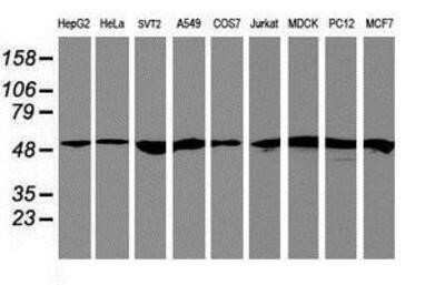 Western Blot: RNF113B Antibody (OTI7A1)Azide and BSA Free [NBP2-73921]