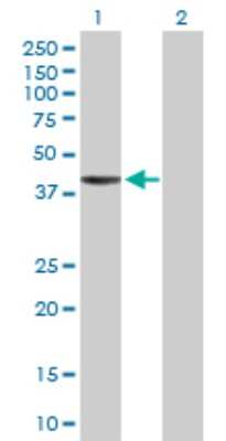 Western Blot: RNF113B Antibody [H00140432-D01P]