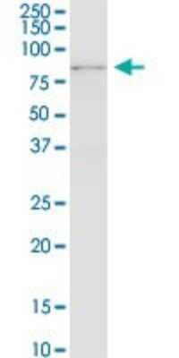 Western Blot: RNF12 Antibody (1G10) [H00051132-M01]