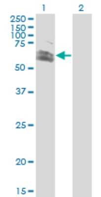 Western Blot: RNF12 Antibody (1G10) [H00051132-M01]