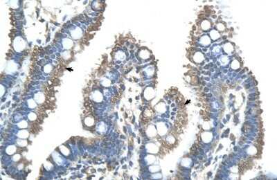 Immunohistochemistry-Paraffin: RNF121 Antibody [NBP1-59772]