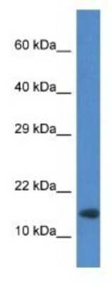 Western Blot: RNF122 Antibody [NBP1-74191]
