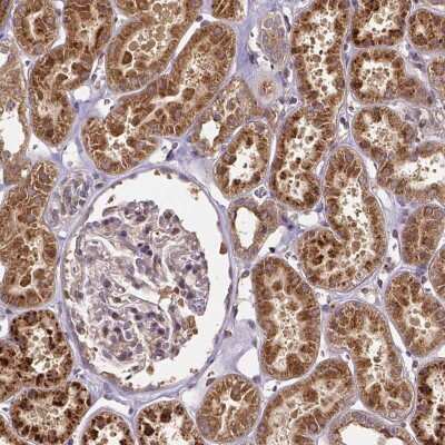 Immunohistochemistry-Paraffin: RNF123 Antibody [NBP2-49467]
