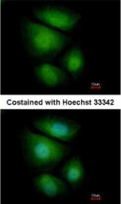 Immunocytochemistry/ Immunofluorescence: RNF13 Antibody [NBP1-31251]