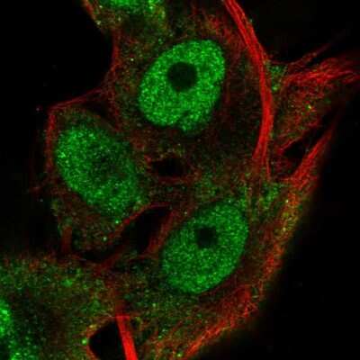 Immunocytochemistry/ Immunofluorescence: RNF13 Antibody [NBP2-57493]