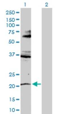 Western Blot: RNF135 Antibody [H00084282-D01P]