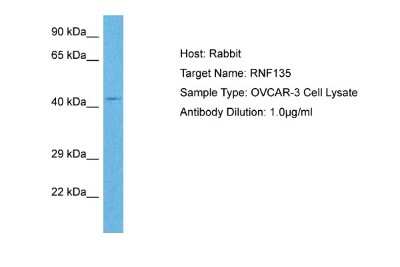 Western Blot: RNF135 Antibody [NBP2-88163]