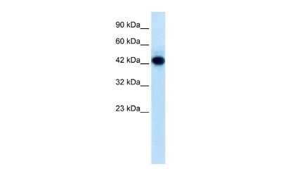 Western Blot: RNF135 Antibody [NBP2-88163]