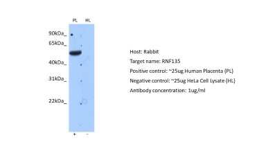 Western Blot: RNF135 Antibody [NBP2-88163]