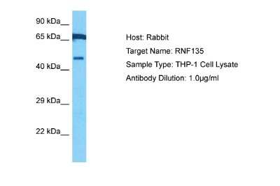 Western Blot: RNF135 Antibody [NBP2-88163]