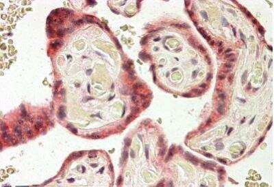 Immunohistochemistry-Paraffin: RNF139 Antibody [NBP1-23027]