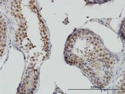 Immunohistochemistry-Paraffin: RNF141 Antibody (6D9) [H00050862-M01]