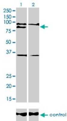Western Blot: RNF141 Antibody (6D9) [H00050862-M01]